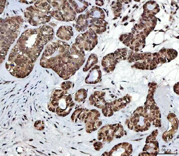 NSUN2 Antibody