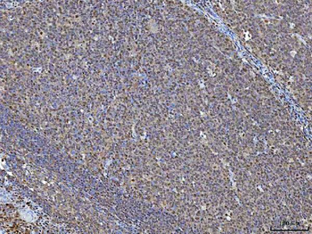 NSUN2 Antibody