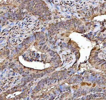 NELF/NSMF Rabbit Polyclonal Antibody