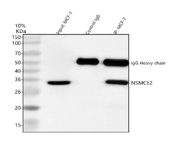 NSMCE2 Antibody