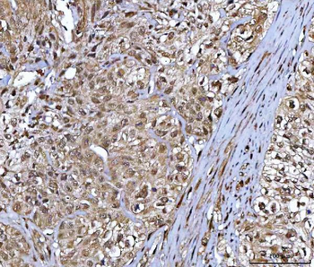 NR5A2 Rabbit Polyclonal Antibody