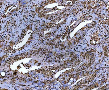 NR5A2 Rabbit Polyclonal Antibody