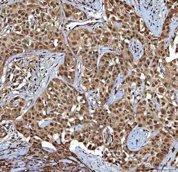 NR2C2 Antibody
