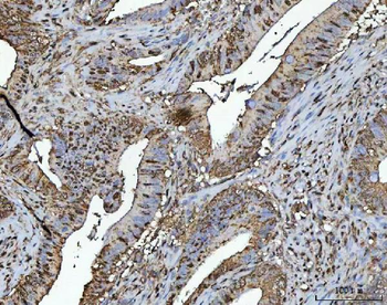 NR2C2 Antibody