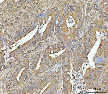 NT5C Rabbit Polyclonal Antibody