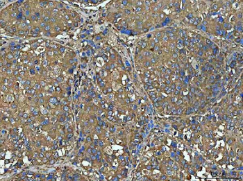 NT5C Rabbit Polyclonal Antibody