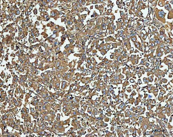 NT5C Rabbit Polyclonal Antibody