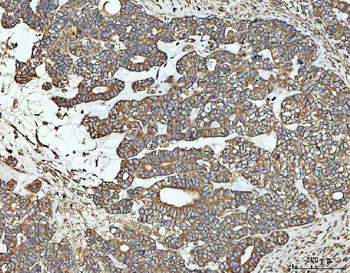 NT5C Rabbit Polyclonal Antibody