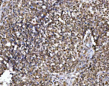 NUP37 Rabbit Polyclonal Antibody