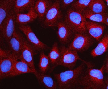 NUDCD3 Rabbit Polyclonal Antibody
