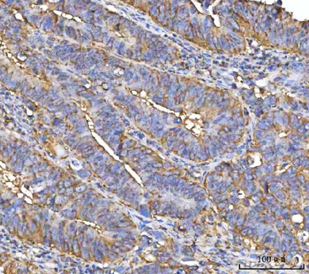NUDCD3 Rabbit Polyclonal Antibody