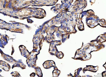 NUDCD3 Rabbit Polyclonal Antibody