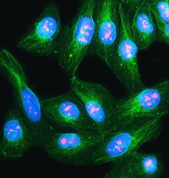 NVL Antibody