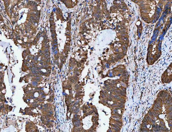 NVL Antibody