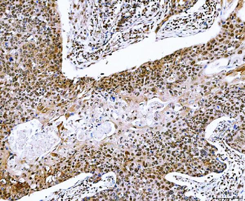 NVL Antibody