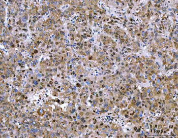 NVL Antibody