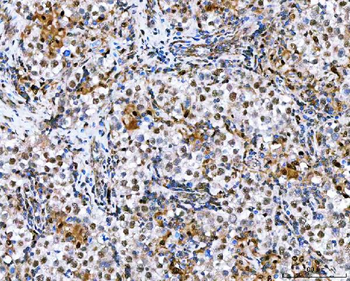NVL Antibody