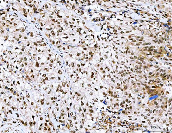 NVL Antibody