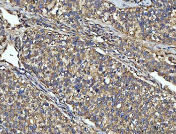 NPEPPS Rabbit Polyclonal Antibody