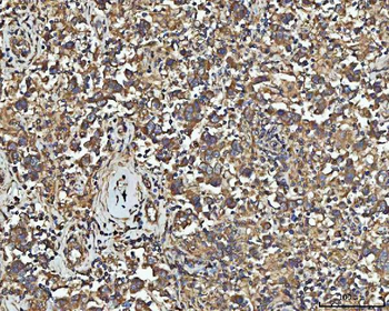 NPEPPS Rabbit Polyclonal Antibody