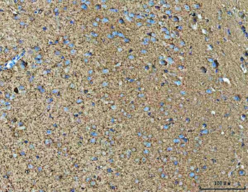 NPEPPS Rabbit Polyclonal Antibody