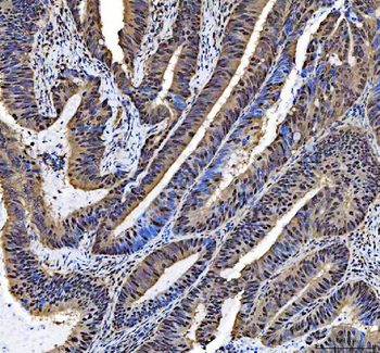 NCOA5 Antibody