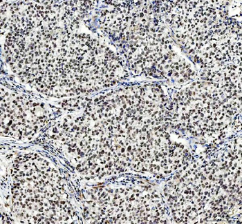 NCOA5 Antibody