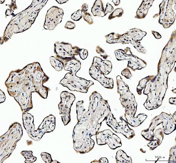 NCOA5 Antibody