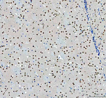 NCOA5 Antibody