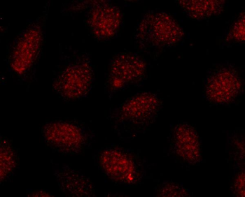 SOX10 Rabbit Polyclonal Antibody