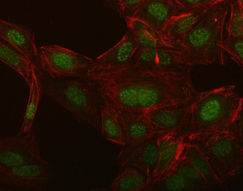 NCX1/SLC8A1 Rabbit Polyclonal Antibody