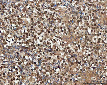 GLI2 Rabbit Polyclonal Antibody