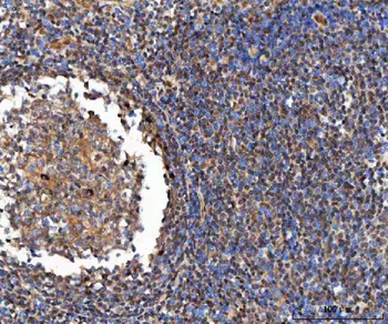 GLI2 Rabbit Polyclonal Antibody