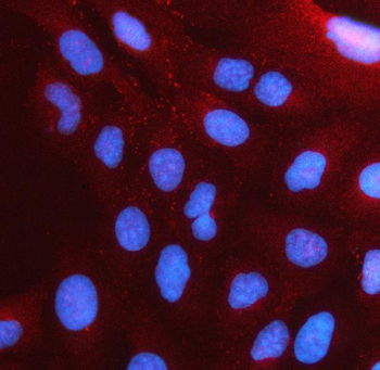 PSTPIP2 Antibody