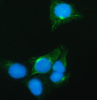SynDIG4/PRRT1 Rabbit Polyclonal Antibody