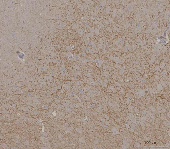 SynDIG4/PRRT1 Rabbit Polyclonal Antibody