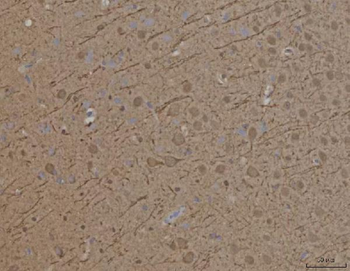 SynDIG4/PRRT1 Rabbit Polyclonal Antibody