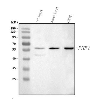 PHF1 Rabbit Polyclonal Antibody