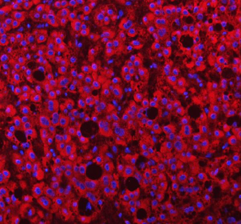 PAPSS2 Antibody