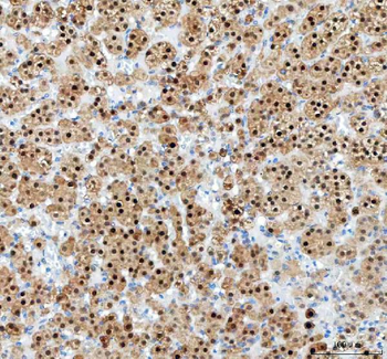 PAPSS2 Antibody