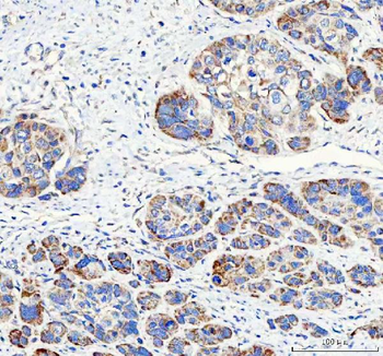 PAPSS2 Antibody