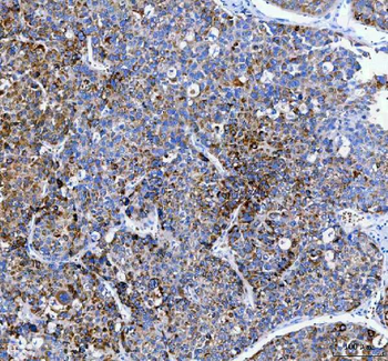 PAPSS2 Antibody