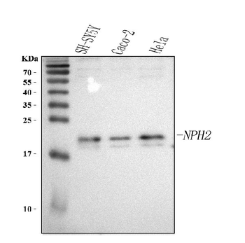 NHP2 Antibody
