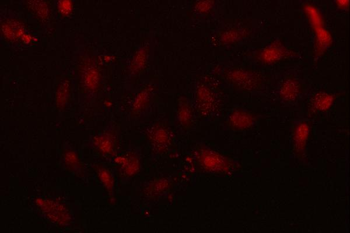 NFIX Rabbit Polyclonal Antibody