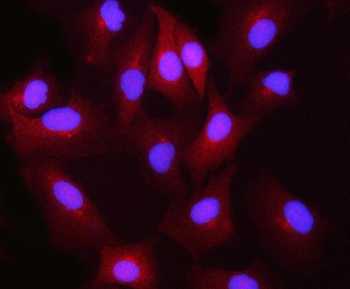 BLVRB Rabbit Polyclonal Antibody