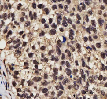 NELFE Rabbit Polyclonal Antibody