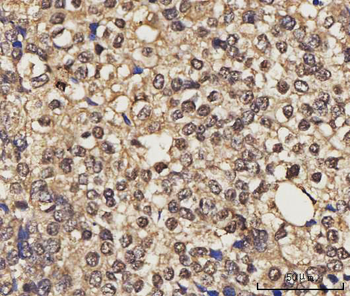 NELFE Rabbit Polyclonal Antibody