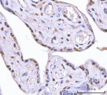 Sam68/KHDRBS1 Antibody