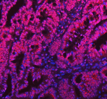 Sam68/KHDRBS1 Antibody