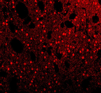 Sam68/KHDRBS1 Antibody